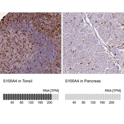 S100A4 Antibody, Novus Biologicals 0.1mL; Unlabeled:Antibodies, Polyclonal